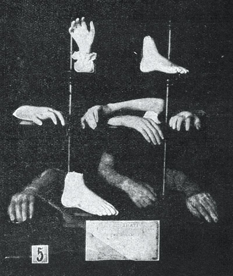 zobrazit detail historického snímku: Zmramorované ruce a nohy lidské.