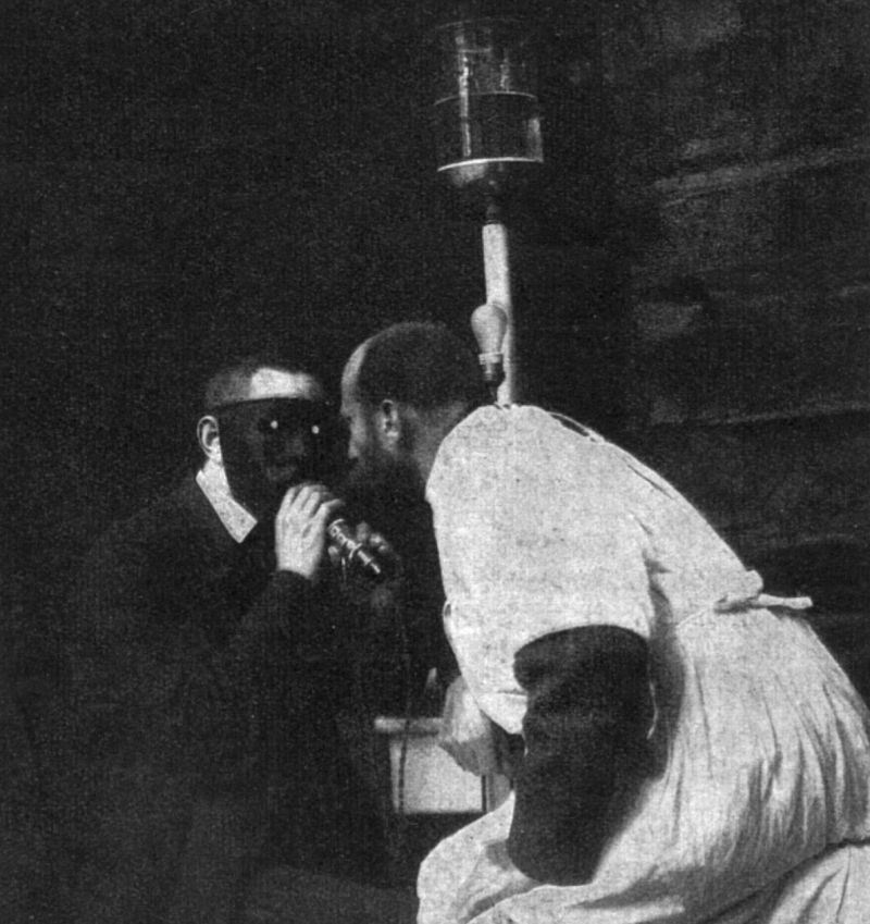 zobrazit detail historického snímku: Prosvícení dutiny očni pomoci ofthalmodiafanoskopu.