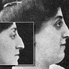 Opravené nosy.