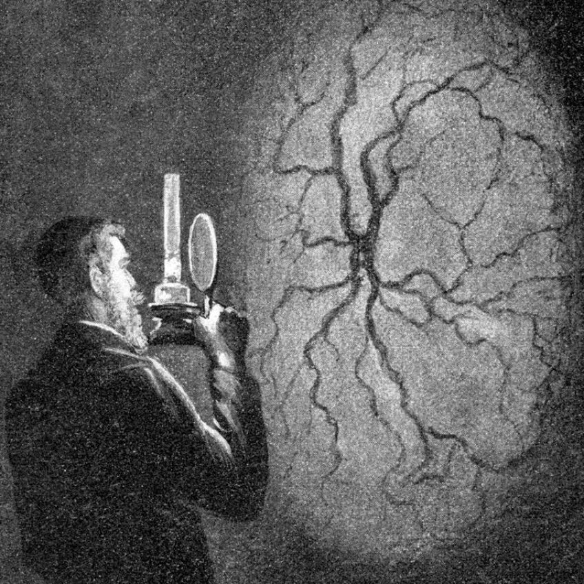 Jednoduchý trik, pomocí kterého si můžete detailně prohlédnout vlastní oko: Článek z roku 1905 vám popíše zajímavý způsob, jak…