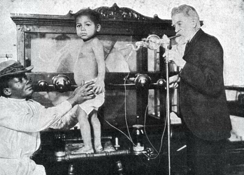 zobrazit detail historického snímku: Bílení černošského dítěte Röntgen-ovými paprsky.