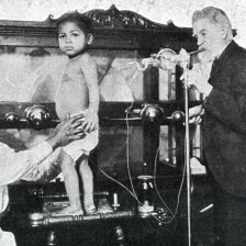 retro fotografie Bílení černošského dítěte Röntgen-ovými paprsky.