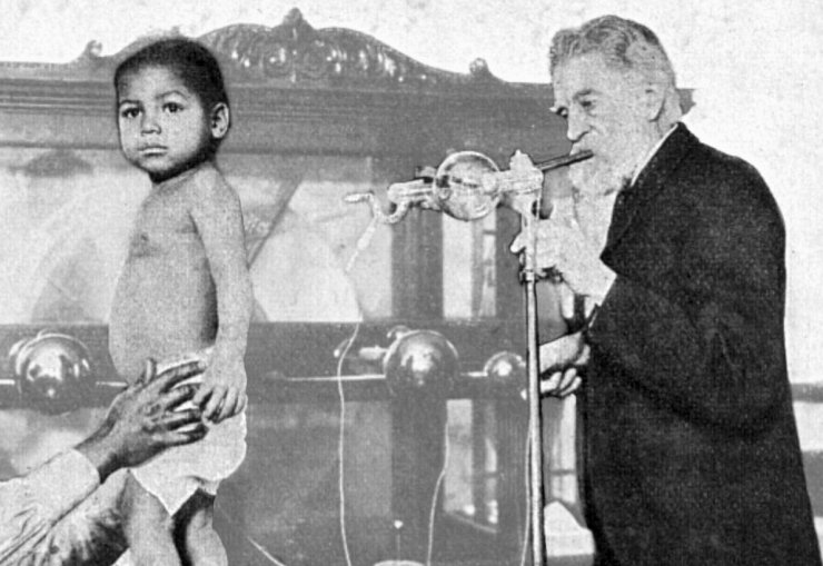 zobrazit detail historického snímku: Bílení černošského dítěte Röntgen-ovými paprsky.